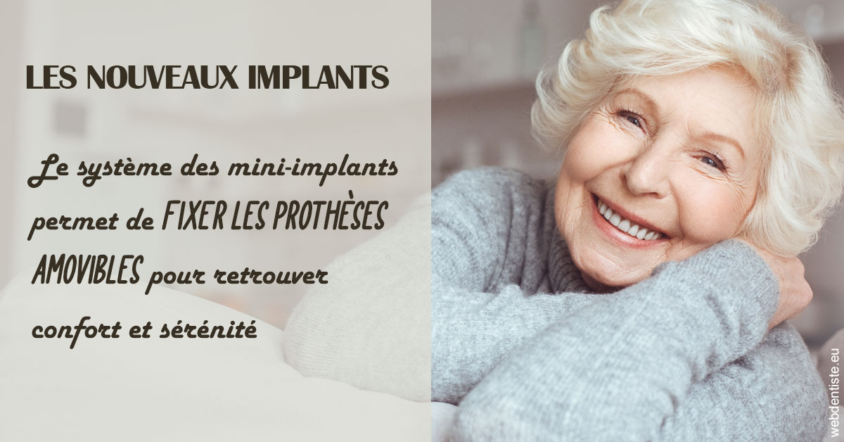 https://www.dentiste-thomas-brossard.fr/Les nouveaux implants 1