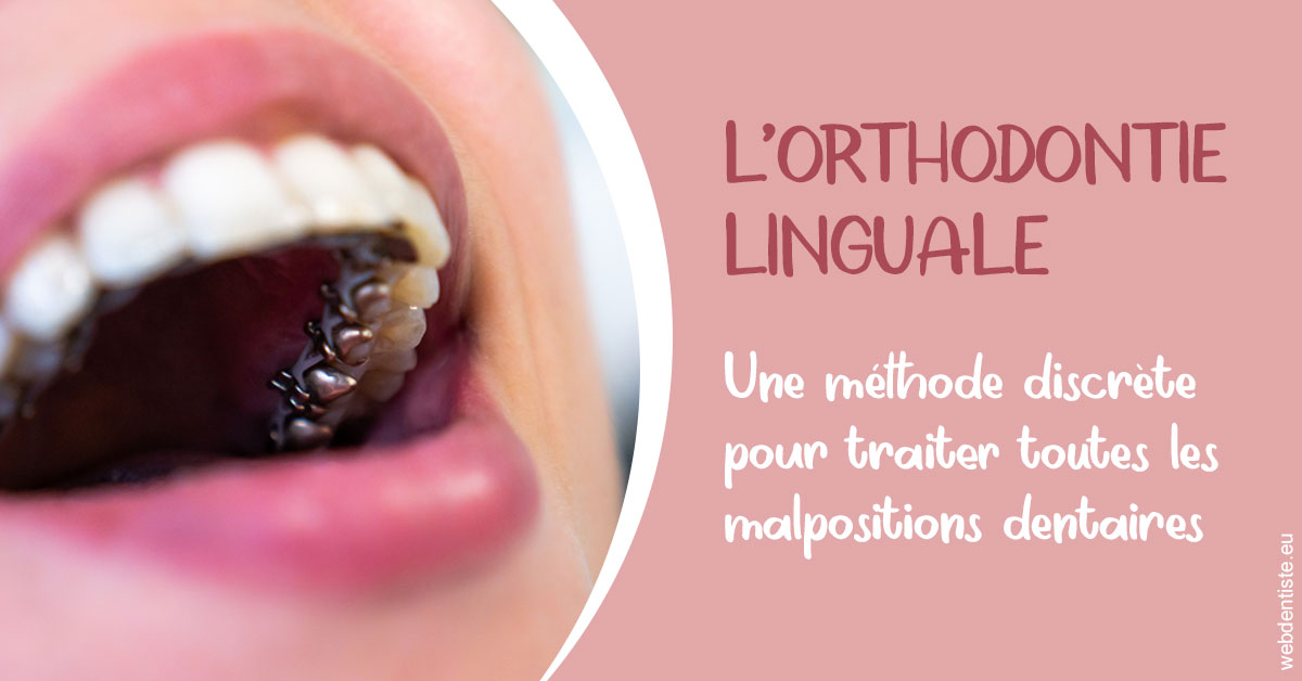 https://www.dentiste-thomas-brossard.fr/L'orthodontie linguale 2