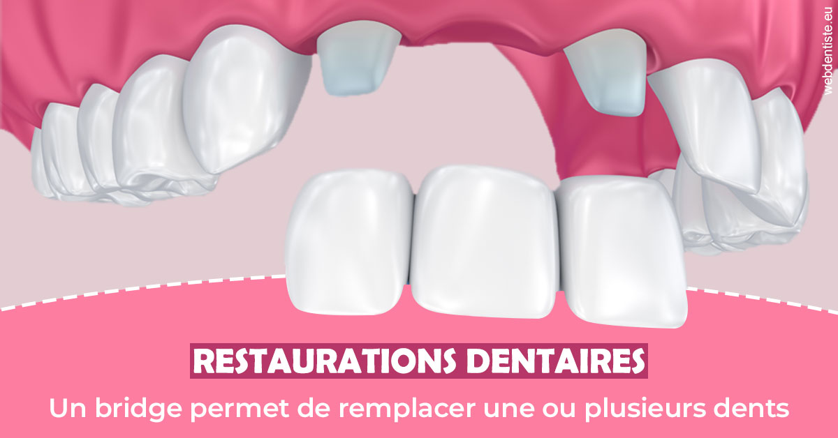 https://www.dentiste-thomas-brossard.fr/Bridge remplacer dents 2
