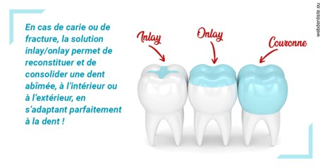 https://www.dentiste-thomas-brossard.fr/L'INLAY ou l'ONLAY