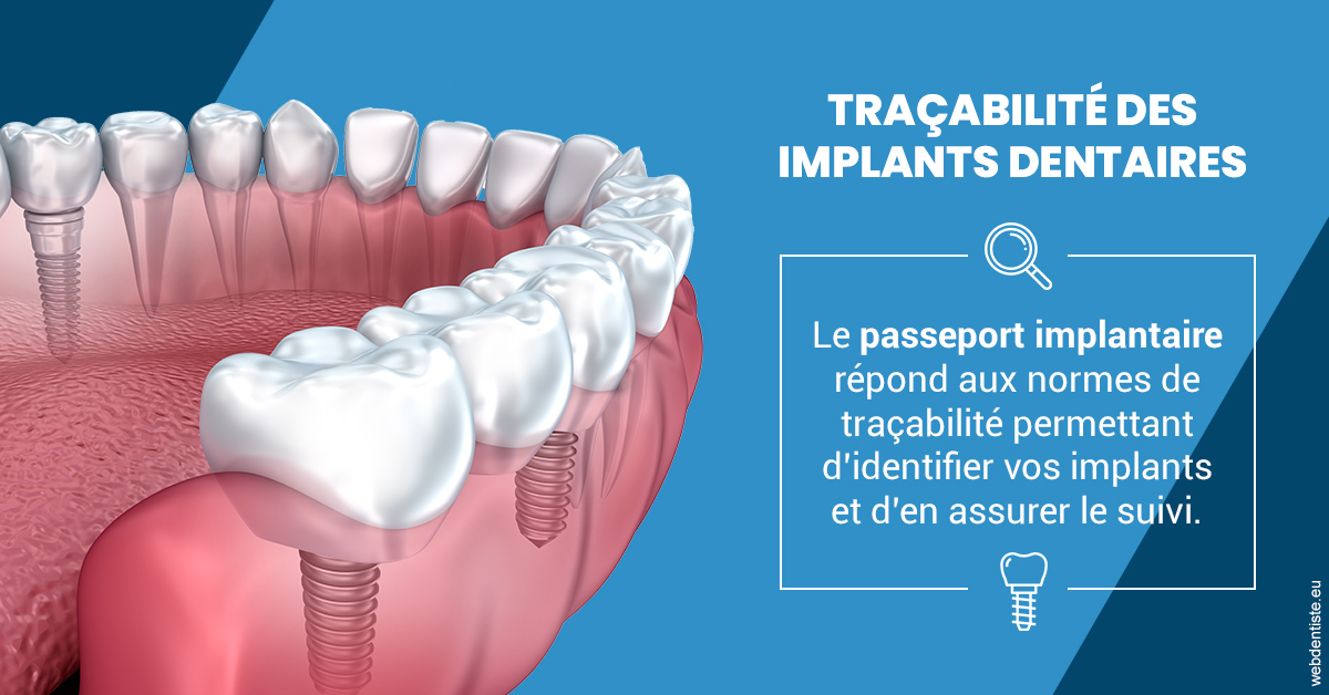 https://www.dentiste-thomas-brossard.fr/T2 2023 - Traçabilité des implants 1