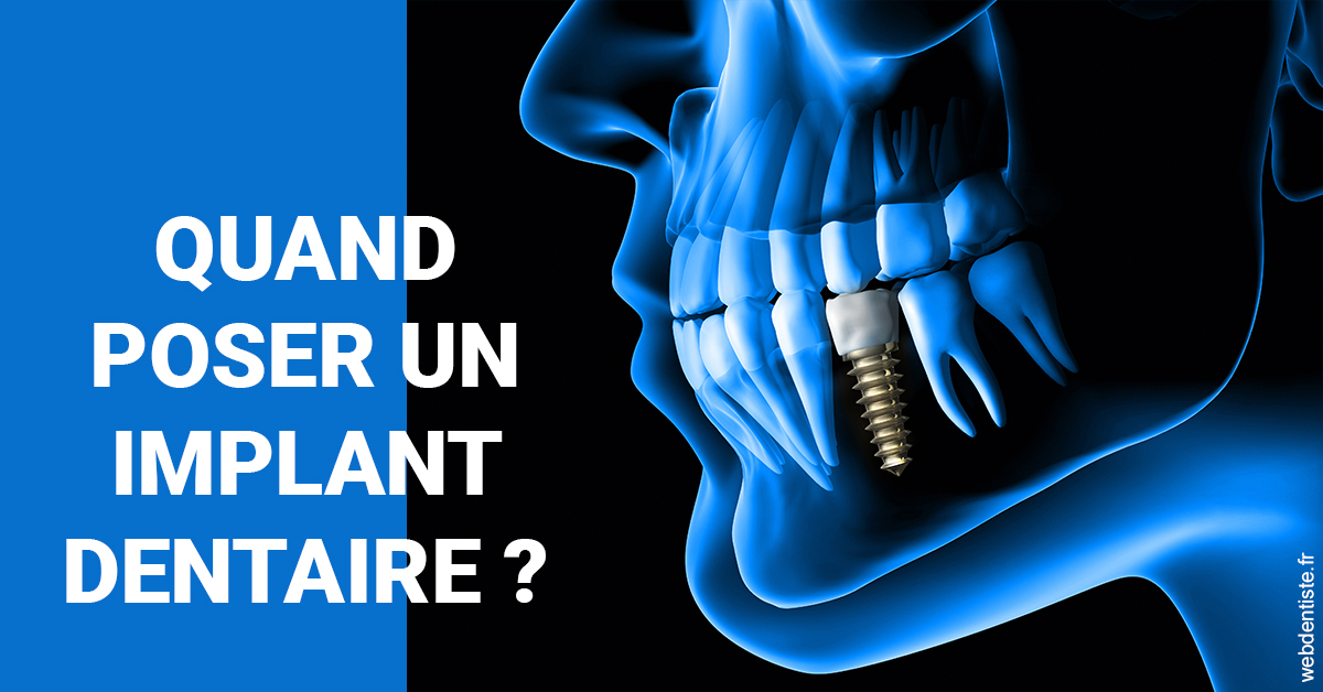 https://www.dentiste-thomas-brossard.fr/Les implants 1