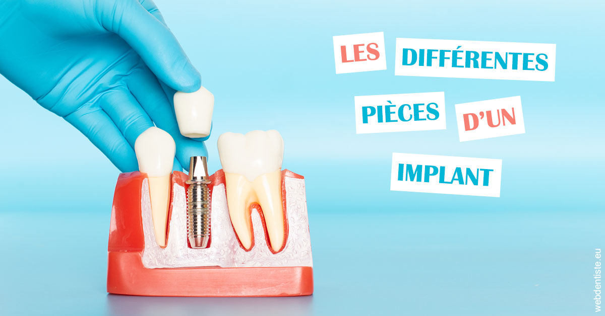 https://www.dentiste-thomas-brossard.fr/Les différentes pièces d’un implant 2