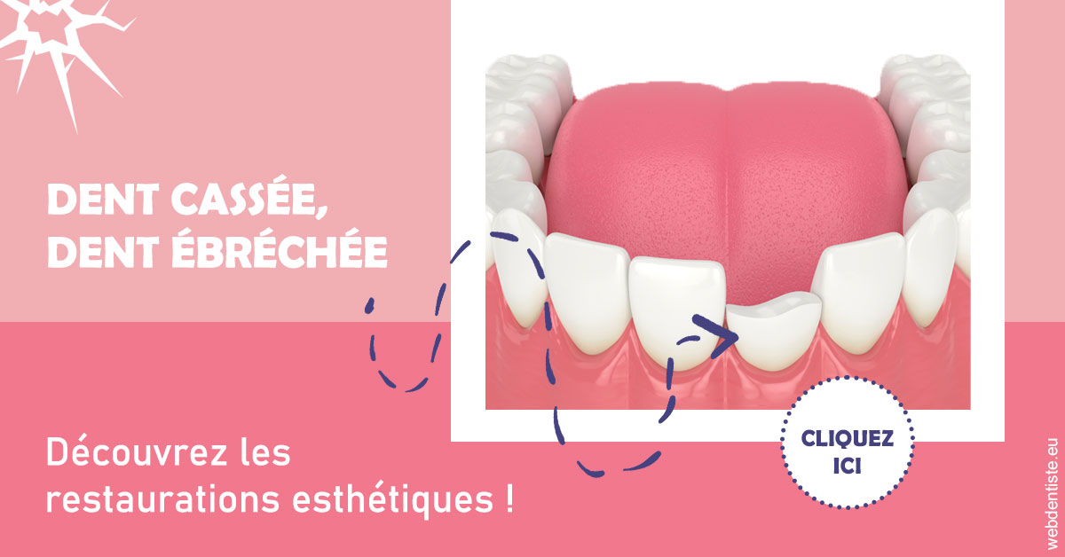https://www.dentiste-thomas-brossard.fr/Dent cassée ébréchée 1