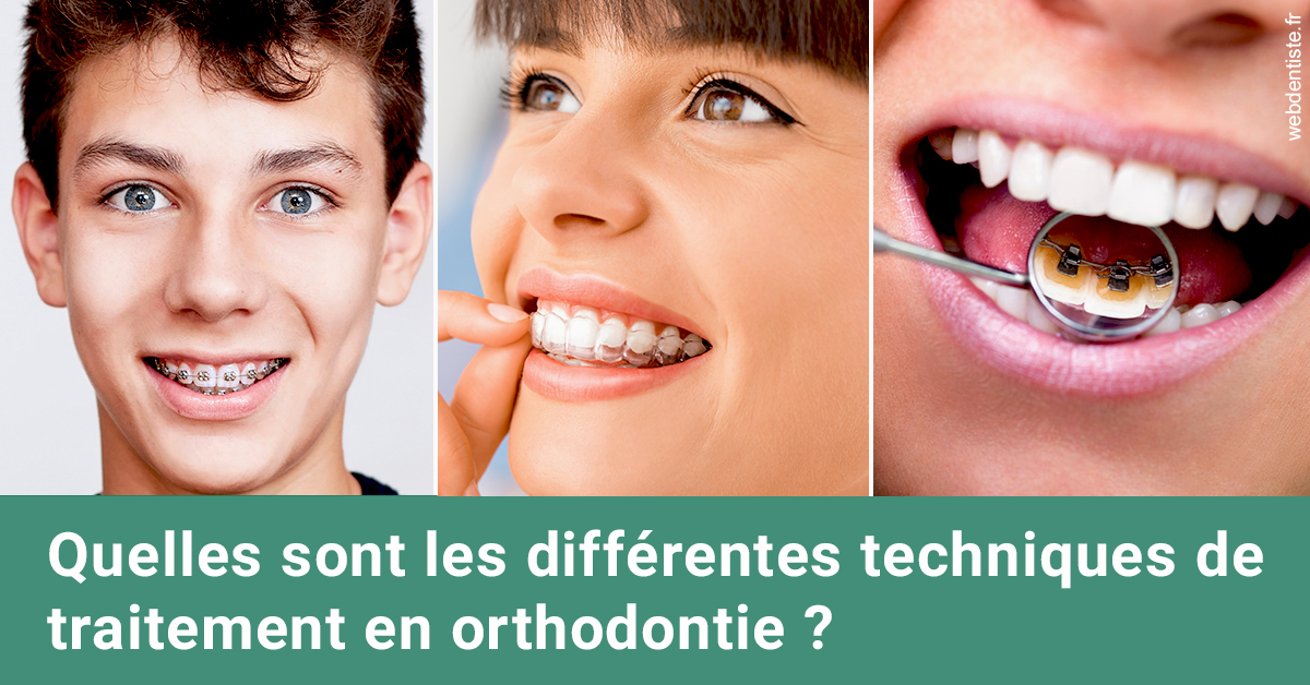 https://www.dentiste-thomas-brossard.fr/Les différentes techniques de traitement 2