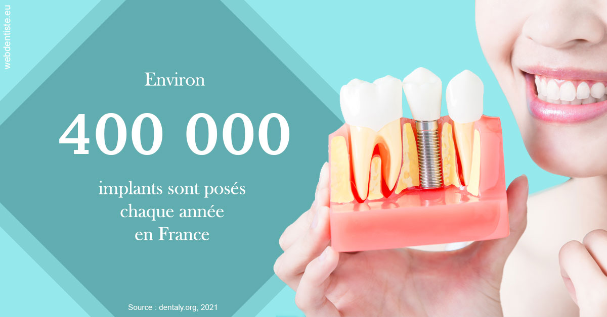 https://www.dentiste-thomas-brossard.fr/Pose d'implants en France 2