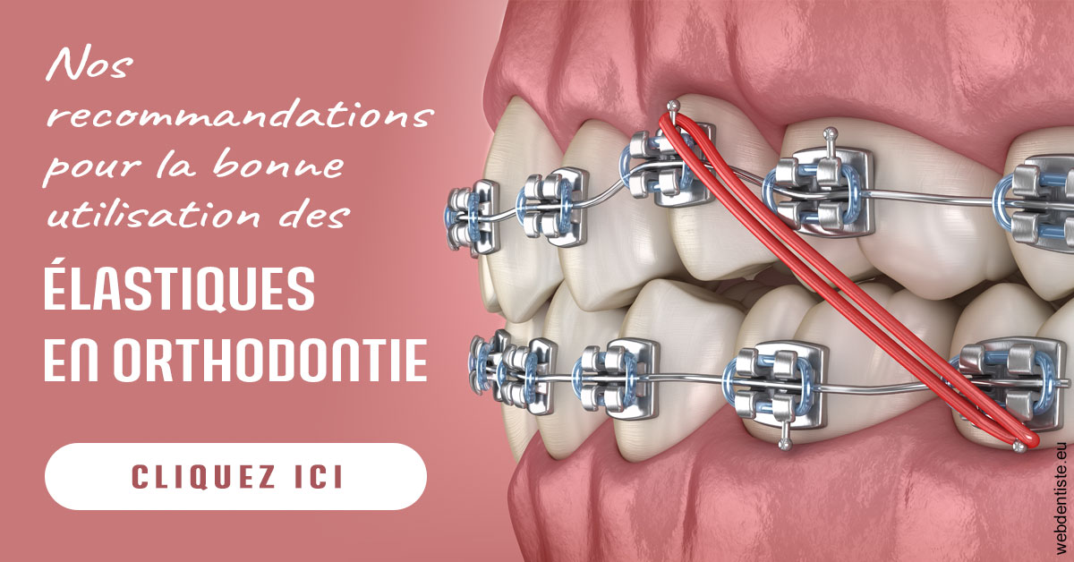 https://www.dentiste-thomas-brossard.fr/Elastiques orthodontie 2