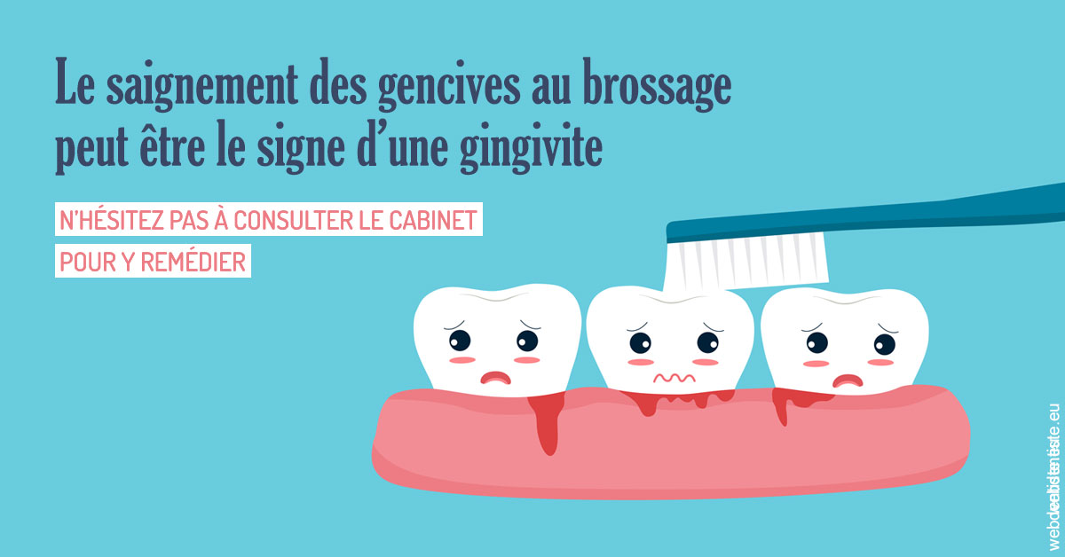 https://www.dentiste-thomas-brossard.fr/2023 T4 - Saignement des gencives 02
